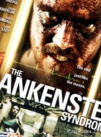 Синдром Франкенштейна (фильм, 2010) смотреть онлайн на Лордфильм